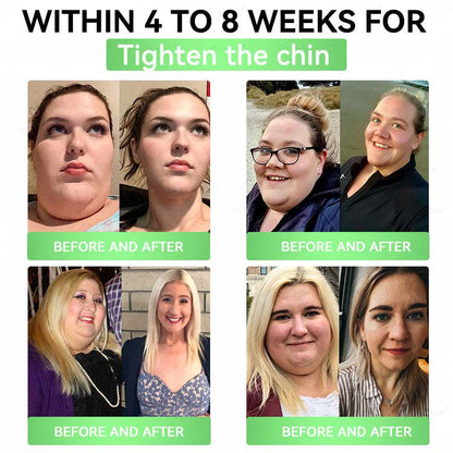 Daily Slim Patch Melt Fat_ Boost Metabolism!