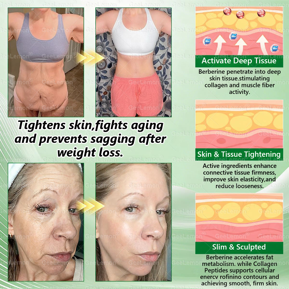 10-in-1 Berberine + NAD+ Advanced Nano Microneedle Patch