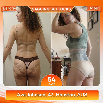 Moringa & Berberine 4‑In‑1 Micro-Particle firming & Fat‑Burn Shorts