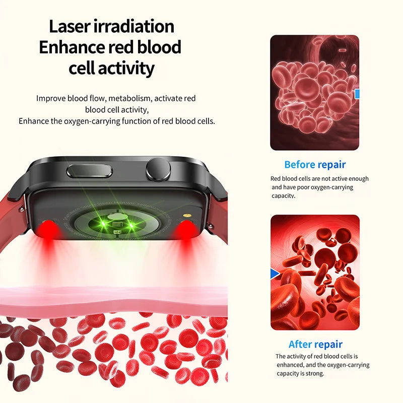 Laser Treatment Smartwatch-Painless Non-invasive Blood Sugar control