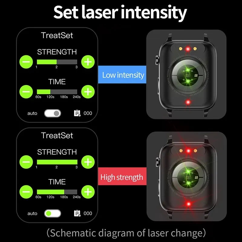 Laser Treatment Smartwatch-Painless Non-invasive Blood Sugar control